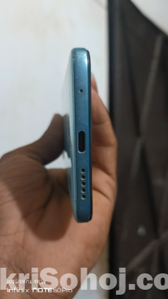 Redmi note 11